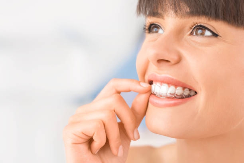 Nowoczesna ortodoncja – innowacyjne sposoby na piękny uśmiech
